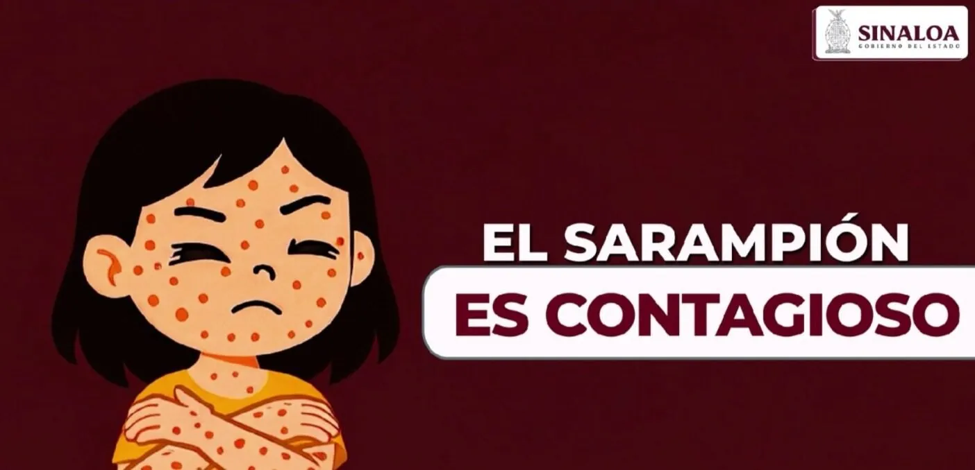 Secretaría de Salud de Sinaloa reitera llamado a vacunarse contra el sarampión Secretaría de Salud de Sinaloa reitera llamado a vacunarse contra el sarampión